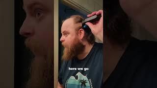 BALDING MAN Younger After TRANSFORMATION