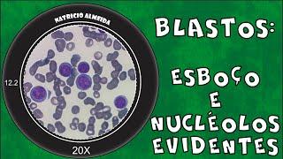 Blastos: Esboço e Nucléolos Evidentes