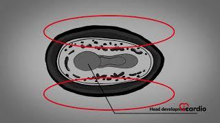 Development of the cardiovascular system