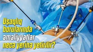 Uşaqlıq borularında əməliyyatlar necə yerinə yetirilir? ( Cərrah mama ginekoloq Aytən Nəcəfəliyeva )