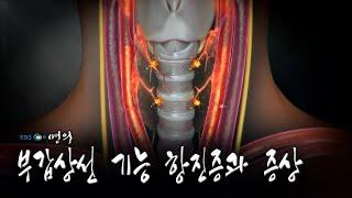 [명의 의학백과] 부갑상선 기능 항진증과 증상