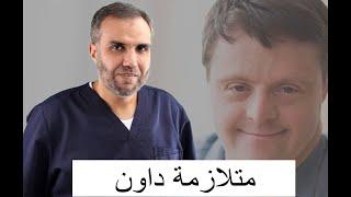 متلازمة داون - الحلقة التاسعة - شفاء - د.حسن مشلح الشمري