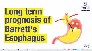 Long Term Prognosis of Barrett's Esophagus | PACE Hospitals #Shortvideo #swallowingdisorders