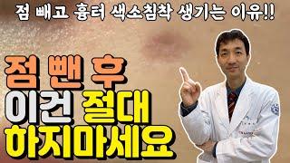 점빼고 흉터 색소침착 남지 않는️ 점제거 후관리 방법!