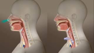 Tracheotomy Care: What Is A Tracheotomy