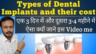 Dental Implants types and their cost in India || डेंटल इम्प्लांट का खर्च ||