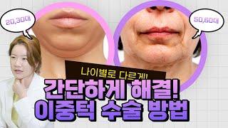 생각보다 쉽고 간단하게 이중턱 지워버리는 방법, 이중턱 수술 총정리!