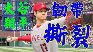 大谷翔平右手肘尺側副韌帶撕裂!! UCL 韌帶撕裂如何治療? 大谷今年還能繼續打擊嗎? #ucl #shohei #ohtani