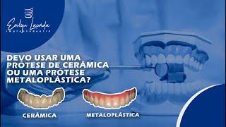 Devo usar uma prótese de cerâmica ou uma prótese metaloplástica?