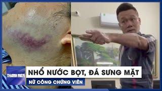 Nữ công chứng viên bị nhổ nước bọt, đá sưng mặt ngay tại văn phòng