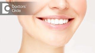 Different types of Veneers - Dr. Krithika