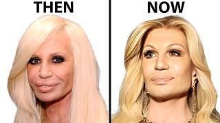 Donatella Versace's NEW FACE | Plastic Surgery Analysis