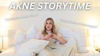 AKNE STORYTIME | Pille absetzen, Isotretinoin Erfahrungen & Vorher/Nachher Bilder 