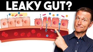 7 Signs of a Leaky Gut — Dr. Berg