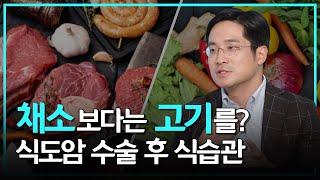 식도암 수술 후 식습관 추천 - 삼성서울병원 폐식도외과 박성용 교수