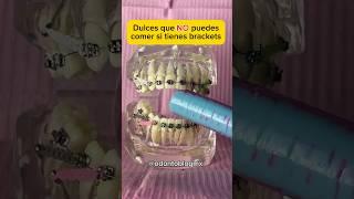 Dulces que NO puedes comer con brackets  #shorts #brackets #ortodoncia #odontoblog