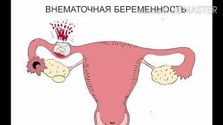 Ectopic pregnancy | Ectopic pregnancy | Earth Mama Co