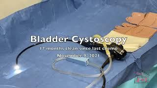 Cystoscopy of Bladder and Prostate- (November 2021)