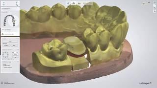 3DBioCAD - 3Shape Dental System Full Anatomical Crown Design