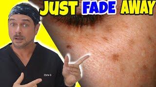 Like MAGIC For Removing Dark Spots & Patches | Chris Gibson