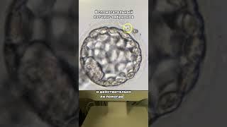 Вспомогательный хетчинг эмбрионов — что это такое, зачем проводится и действительно ли помогает? ⤵️