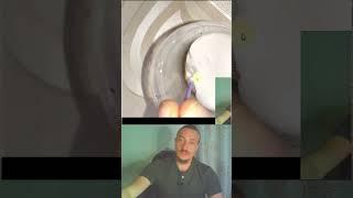 Как Черный Тмин подавляет грибки в кишечнике #грибок  #здоровье #кандида  #подмикроскопом