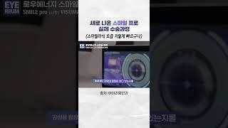 스마일 프로 수술 공개 [실제상황] – 스마일라식 수술영상