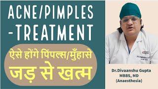 Acne/Pimples Treatment ,Muhase Kaise Hataye,  ऐसे होंगे पिंपल्स /मुँहासे जड़ से खत्म l THYDOC HEALTH