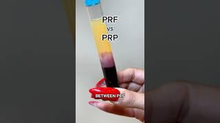 PRP vs PRF- find out the difference in this video ⏯️🩸 #prp #prf #undereyedarkcircles #eyetreatment