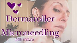 Come uso il Dermaroller/Microneedling | Pelli mature