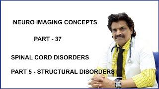 NEURO IMAGING CONCEPTS PART-37,SPINAL CORD DISORDERS.PART 5 - STRUCTURAL DISORDERS