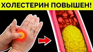 Вот как обнаружить ВЫСОКИЙ ХОЛЕСТЕРИН! Методы снижения ХОЛЕСТЕРИНА