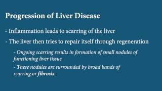 Liver Disease - Fibrosis