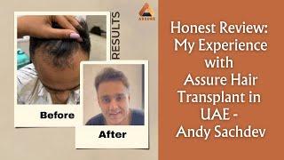 Honest Review: My Experience with Assure Hair Transplant in UAE - Andy Sachdev