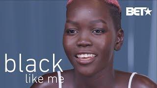 This Viral Model Sensation Wanted to Bleach Her Skin to Fit In | Black Like Me