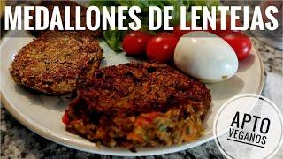 MEDALLONES DE LENTEJAS | RIQUISIMOS Y SANOS! (APTO VEGANOS)