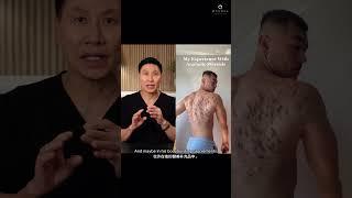 Dr. Thean Reacts: Does Anabolic Steroids Cause Acne? | Ensoul Medical Clinic