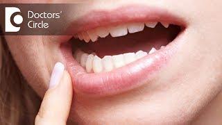 What are the reasons for swelling around the last tooth?-Dr. Sowmya Vijapure