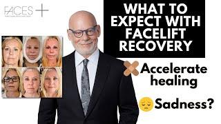 Facelift Recovery - What to Expect