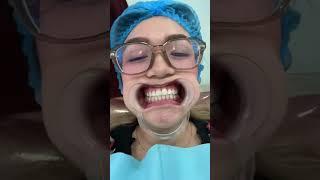 4-7 shades lighter teeth after 1 session! Thankyou Ampong dental clinic. #dental #teethwhitening