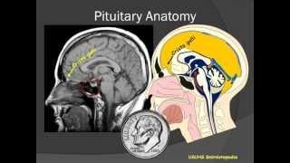 Amenorrhea and Galactorrhea