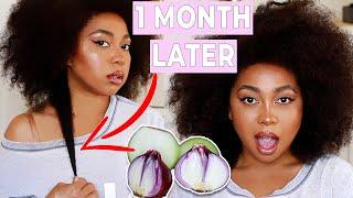 ONION JUICE FOR EXTREME HAIR GROWTH? (HOW YOU CAN USE ONION JUICE FOR MASSIVE HAIR GROWTH, UPDATE)