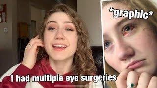 STORYTIME: I HAD A RETINAL DETACHMENT AND NEEDED MULTIPLE SURGERIES AT 18 YEARS OLD