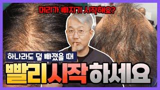 탈모: 효과적으로 탈모치료 하는 법 돈낭비 하지마세요(feat.탈모 자가진단)KOR