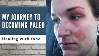 My journey to the paleo diet (from living in mold to healing with food)