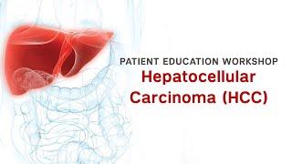 Workshop | Hepatocellular Carcinoma (HCC)