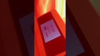 🩺 CADScor AI: Revolutionizing Coronary Artery Disease Detection with 96% Accuracy