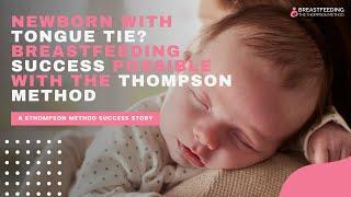 Newborn with Tongue Tie? Breastfeeding Success Possible with the Thompson Method