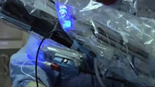Video about how an Iowa hospital is preventing surgical site infections