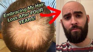 Embracing My Hair Loss After FOUR YEARS! | From Thick Hair To Balding in my 20s | PODCAST #1